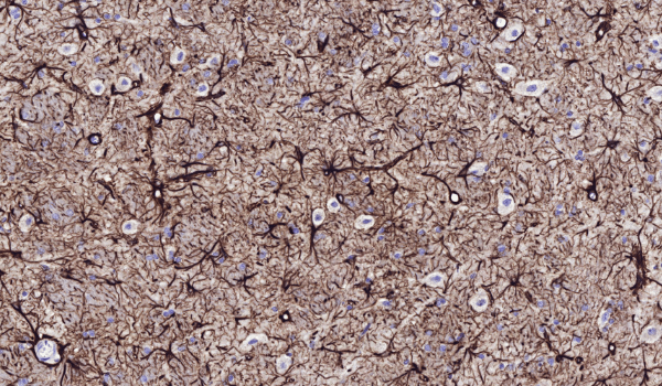 Orion Pharma case study: accelerating preclinical neurotoxicity analysis with AI