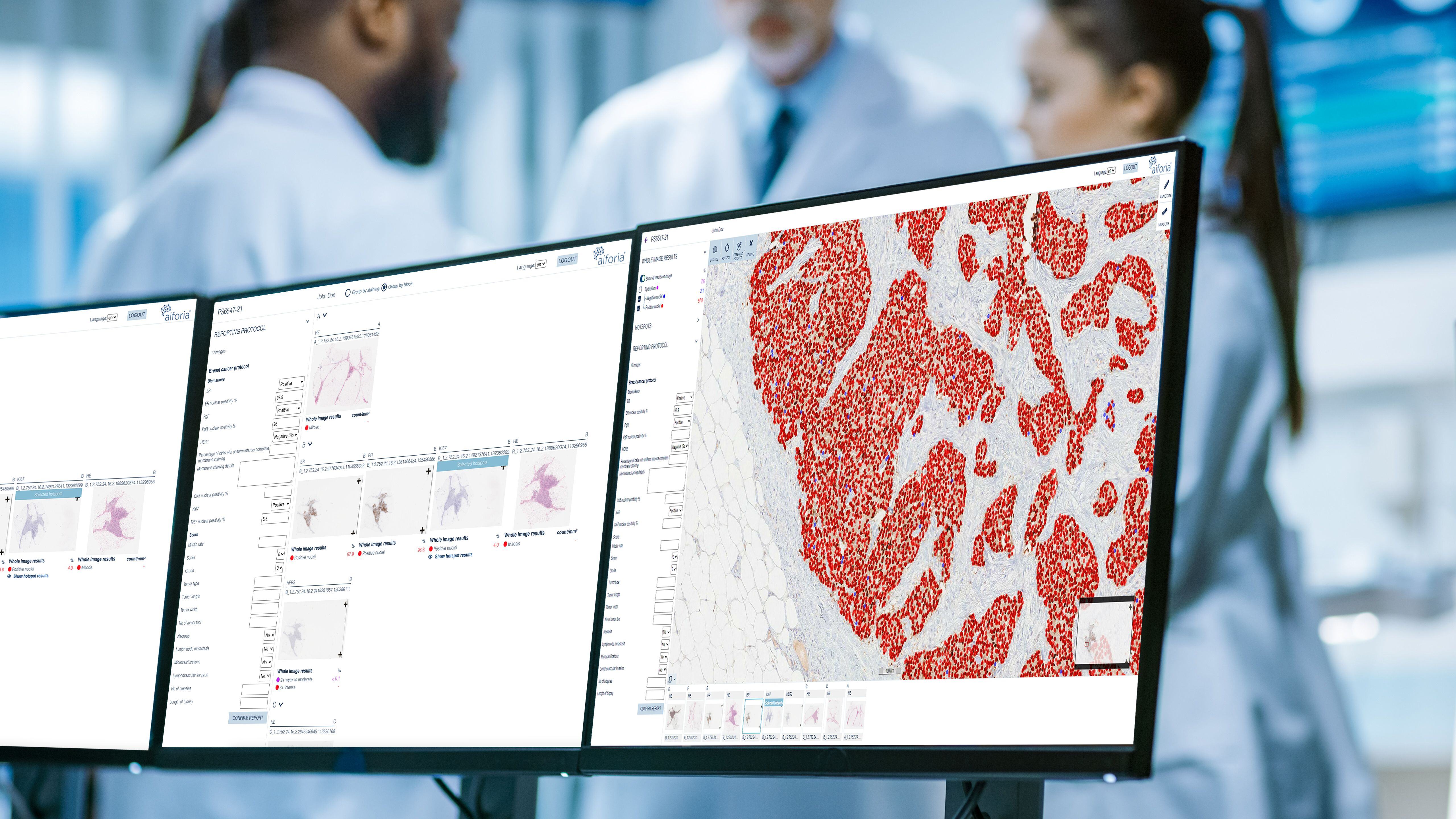 ER cells with viewer