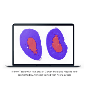 kidney tissue segmented by AI model