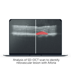 Interview with experimentica