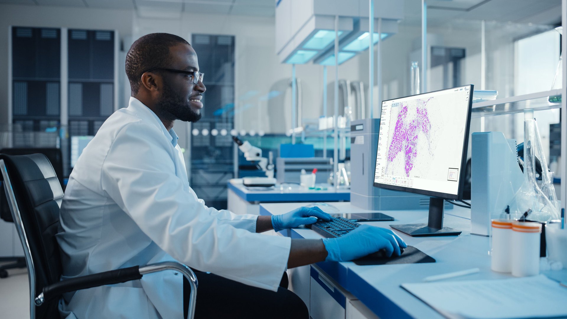 Ki67 epithelium clinical