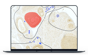 training AI model for rat ovarian follicles