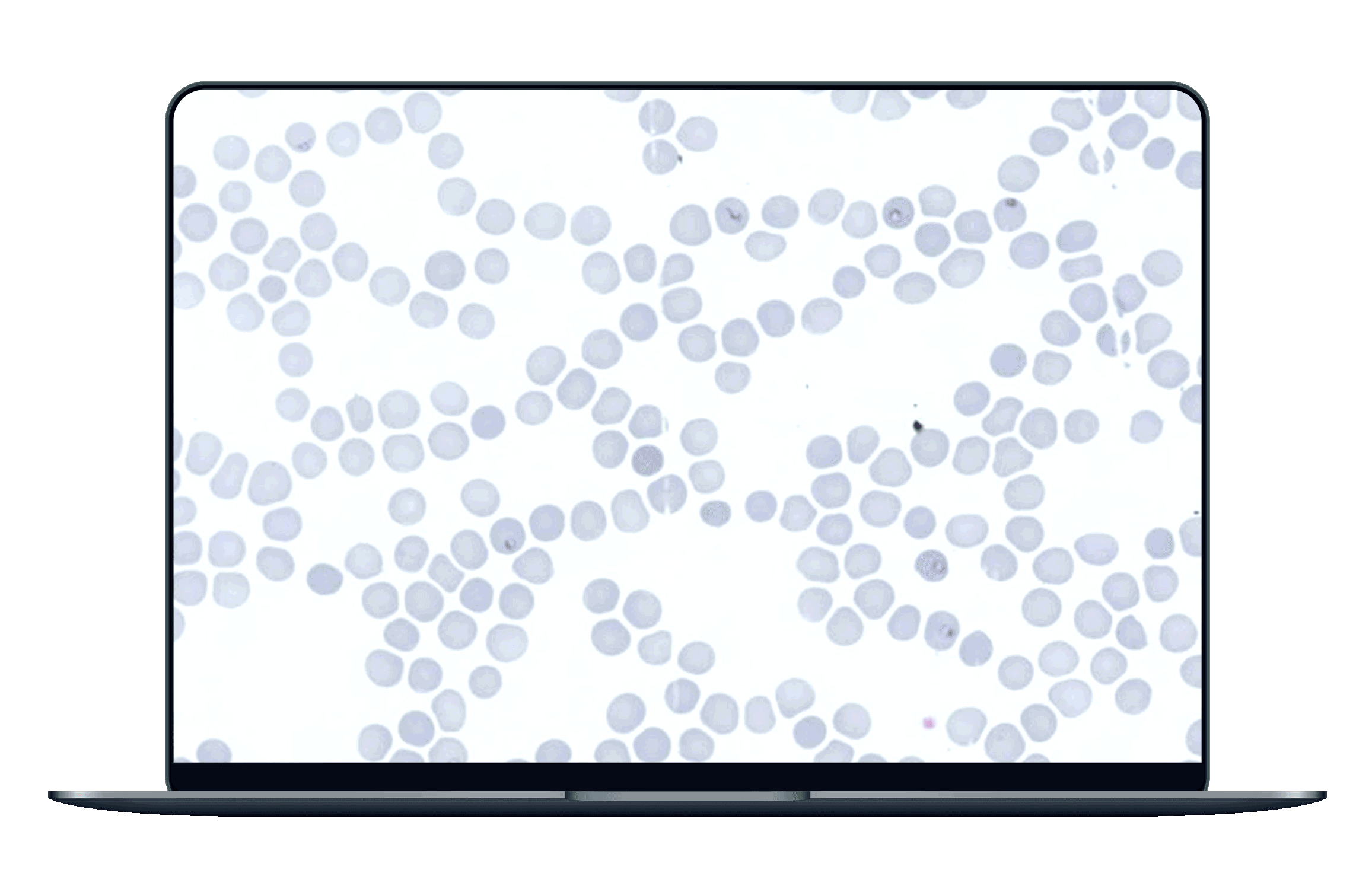 laptop_malaria