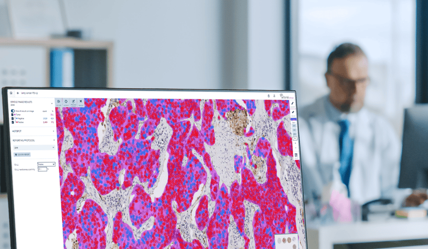 Castile and León case study: better patient care with AI-assisted diagnostics