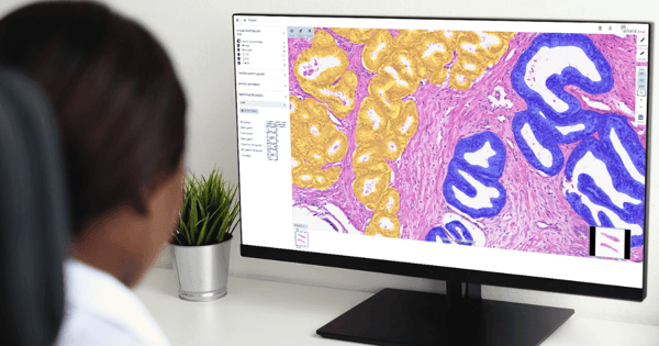 APHP press release_blog banner-2