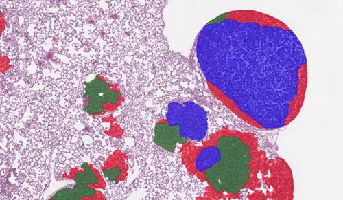 Aiforia and Orion collaborate to develop AI solutions for image analytics in drug research