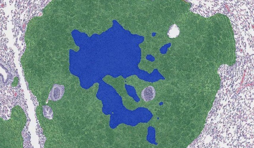 Case study: applying AI-powered histopathological grading for mouse lung tumors