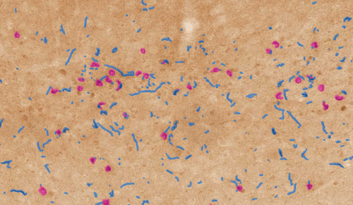 Case study: Preclinical brain-wide histopathology analysis performed in hours
