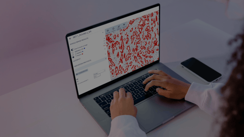 Aiforia expands its portfolio of CE-IVD marked clinical pathology solutions with new AI model for breast cancer diagnostics