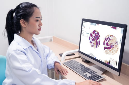 How AI can improve the speed and accuracy of breast cancer diagnostics