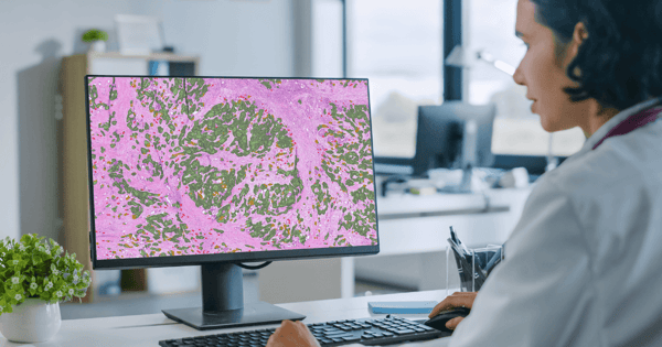 Blog post Democratizing AI-1