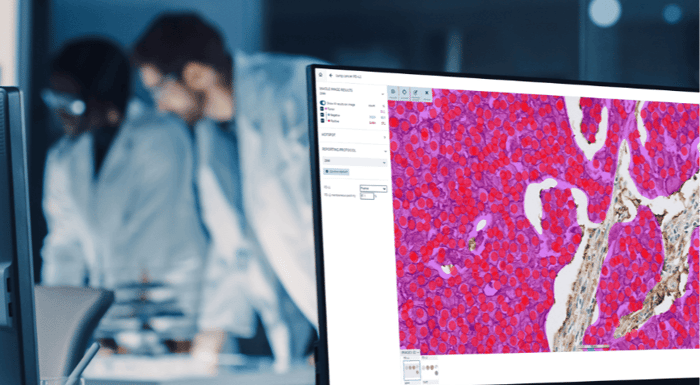 Benefits of digital pathology