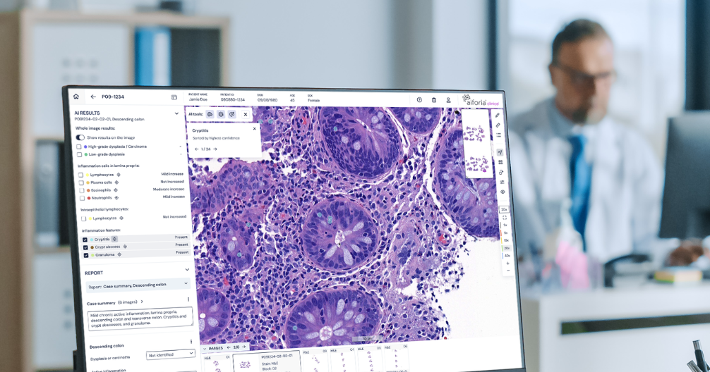 Rising colonoscopy biopsy volumes are outpacing pathologists_blog banner-1-1