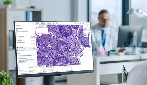 Rising colonoscopy biopsy volumes are outpacing pathologists