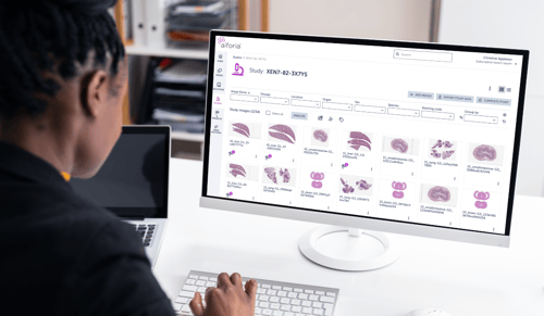 Aiforia releases Aiforia® Studies, a pioneering GLP-compliant AI-assisted image analysis workflow for non-clinical histology studies