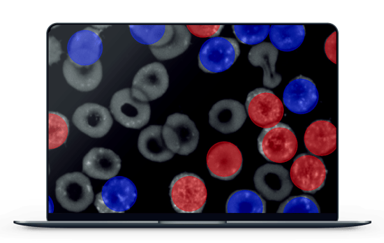 Blog Image - Coronavirus