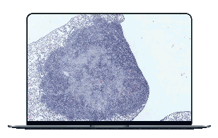 Blog Image - Infectious Diseases GIF_laptop
