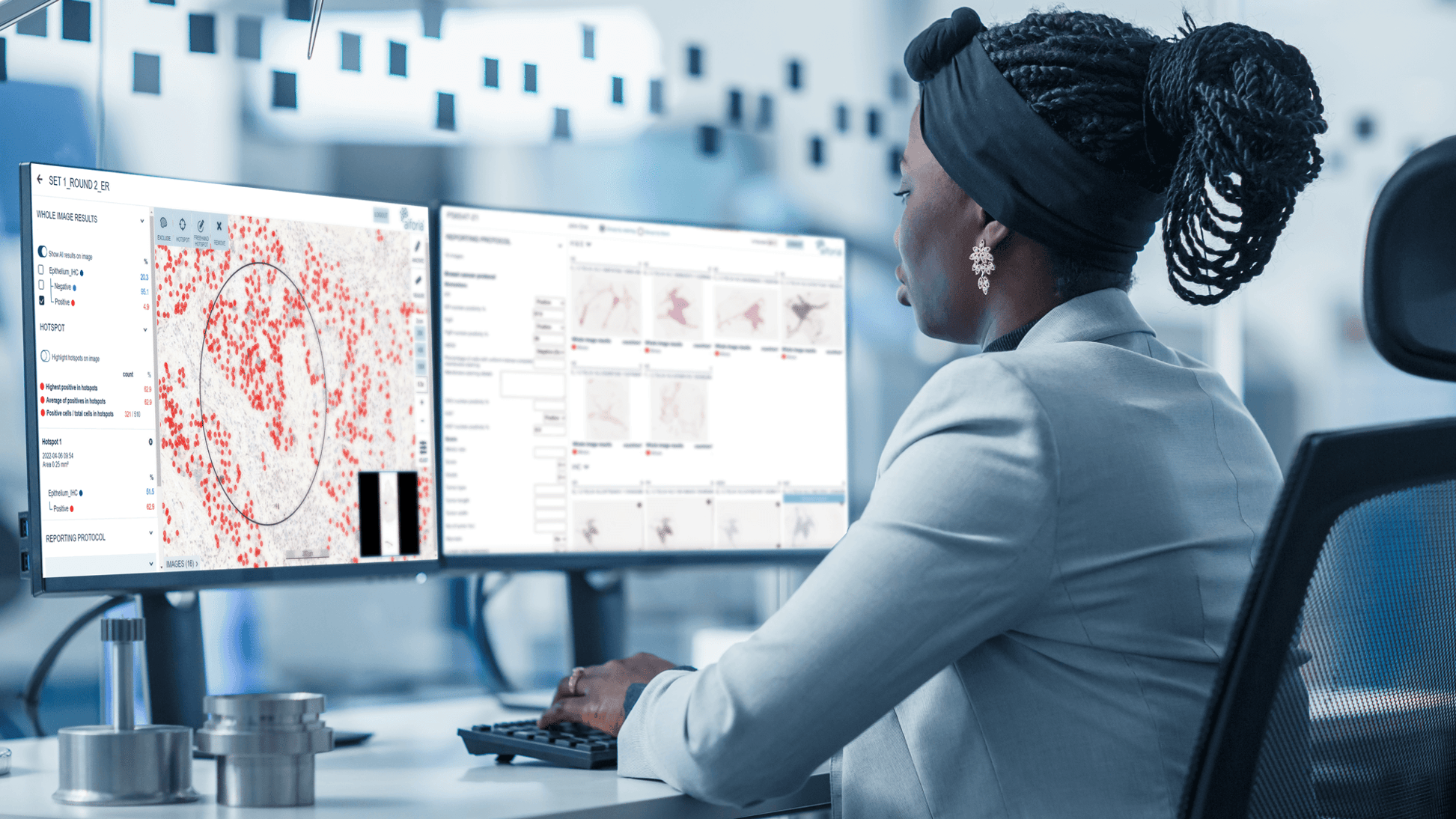 How AI can improve the speed and accuracy of breast cancer diagnostics