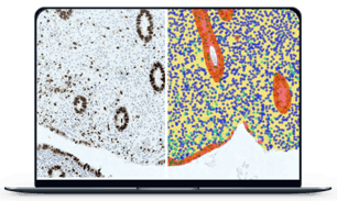 Endometrial cell_laptop