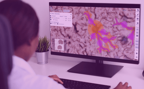 Aiforia® Create: from research AI models to productization for clinical practice