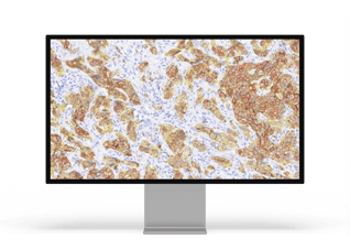 HER2_monitor 1