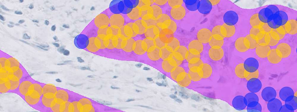 HER 2 low_webinar LP banner