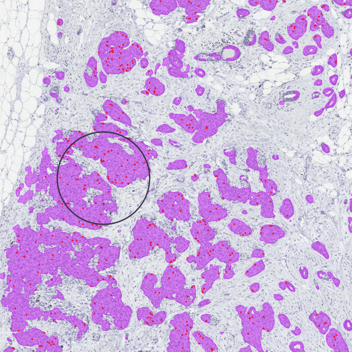 Aiforia’s CE-IVD marked clinical AI models for Ki67