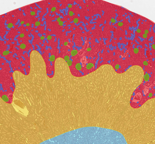 Automating the quantification of chronic changes in kidney histology