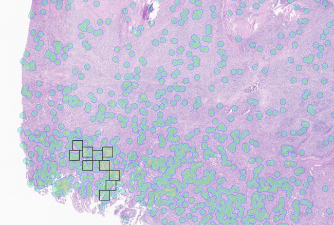 Aiforia® Mitosis Epithelial