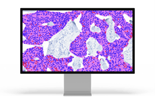 www.aiforia.comhs-fshubfsPR_monitor