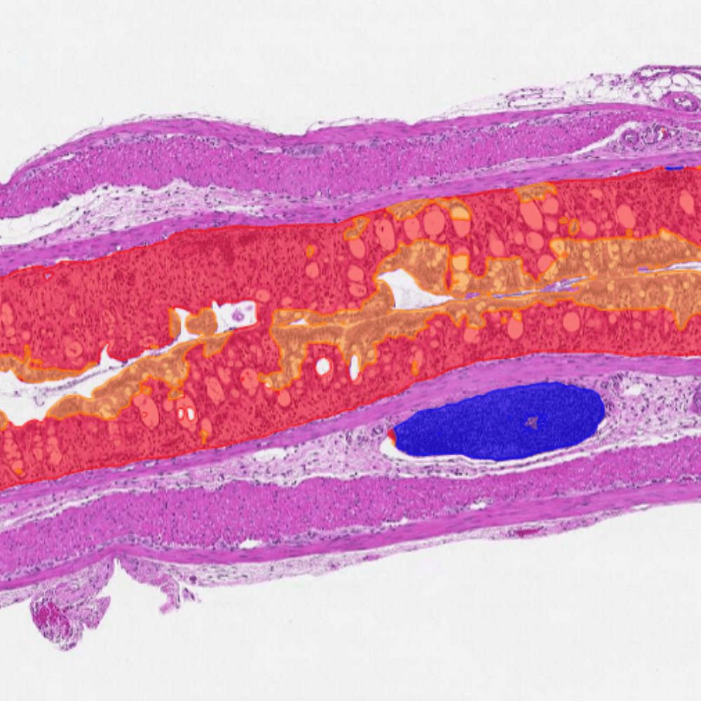 Quantitative evaluation of DSS-induced colitis with AI