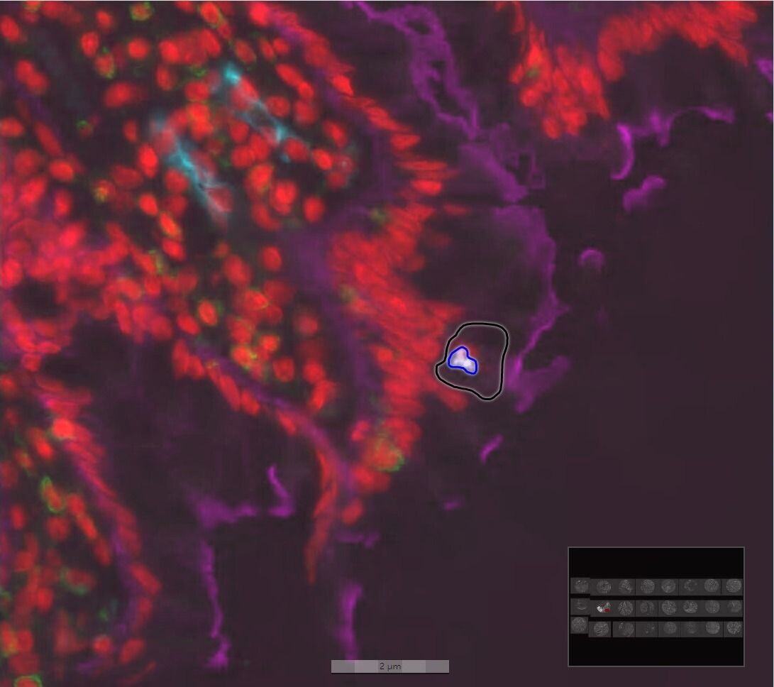 Human Colon Multichannel 1