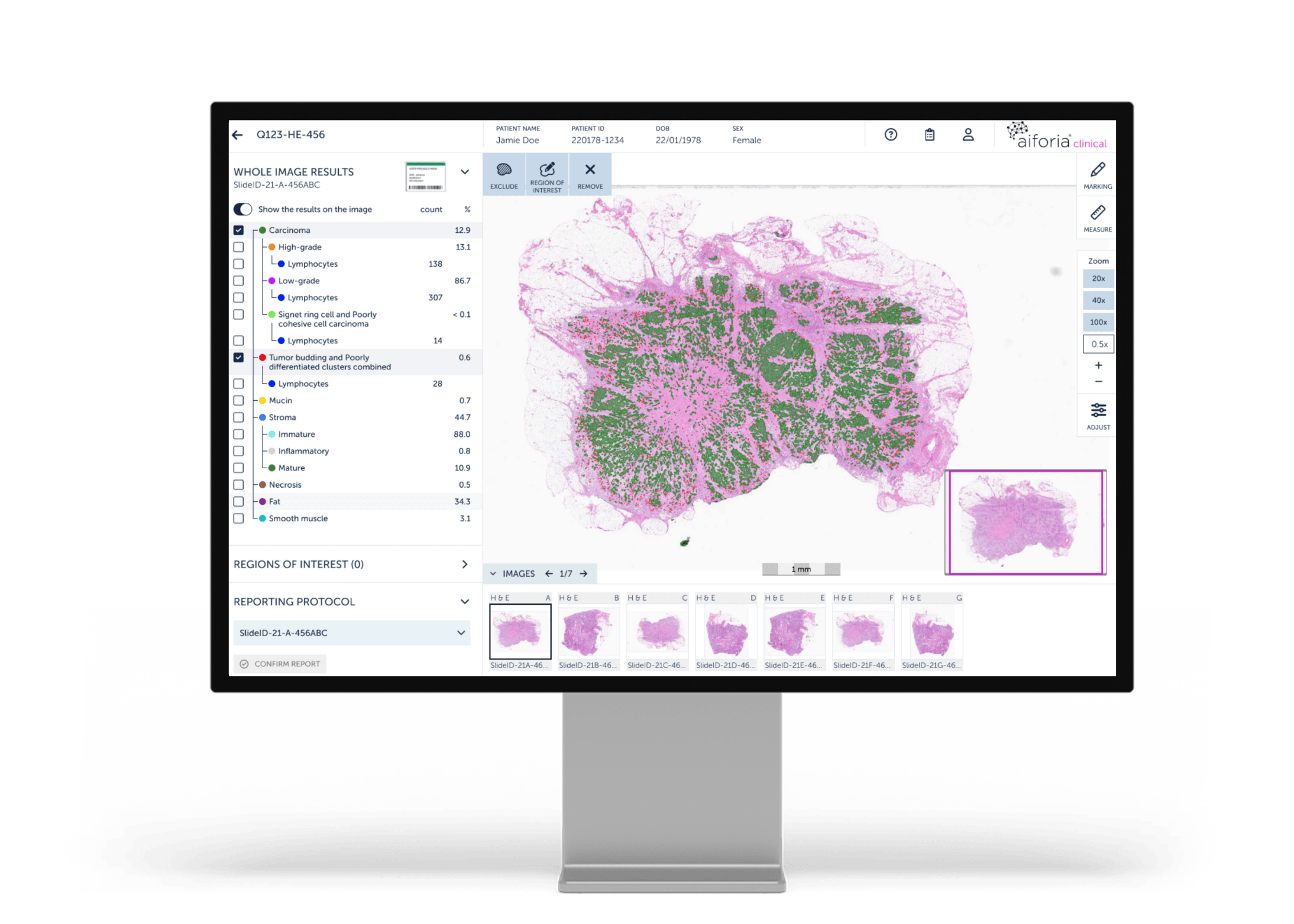 QuantCRC_monitor 1
