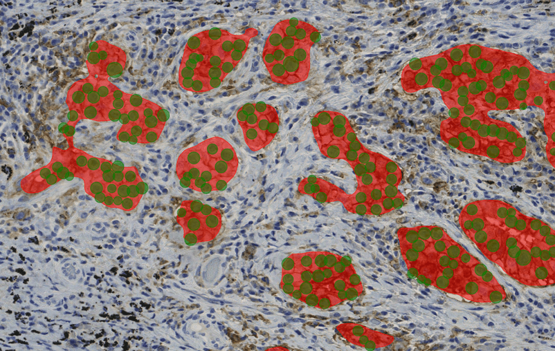 Case study: validation of PD-L1 AI model in six labs in the Netherlands