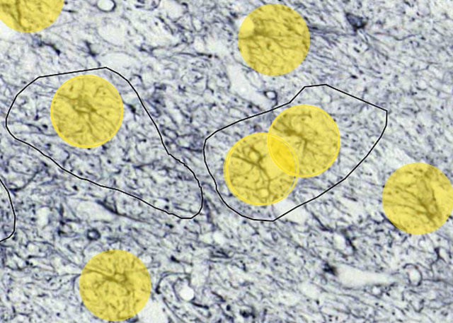 astrocytes_PD_after