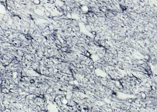 astrocytes_PD_before