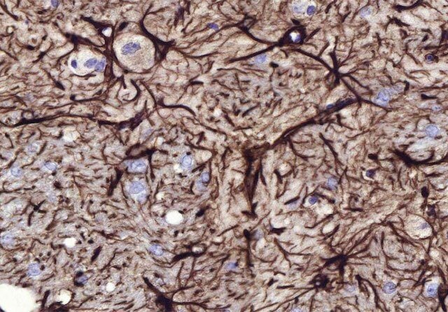 Orion Pharma case study: accelerating preclinical neurotoxicity analysis with AI