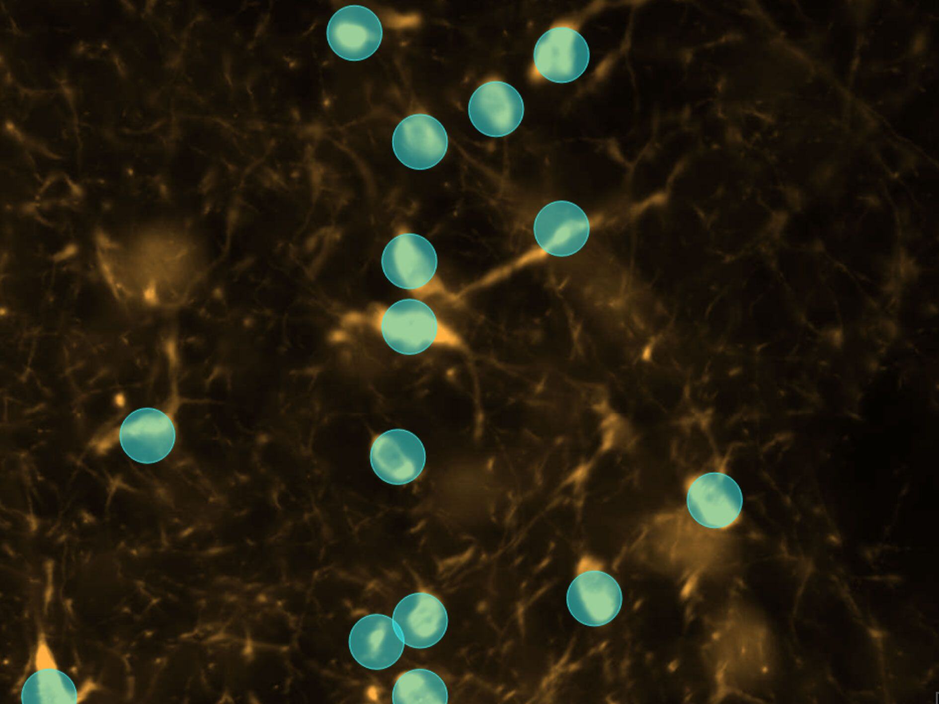 dopamine_neuron_PD_after