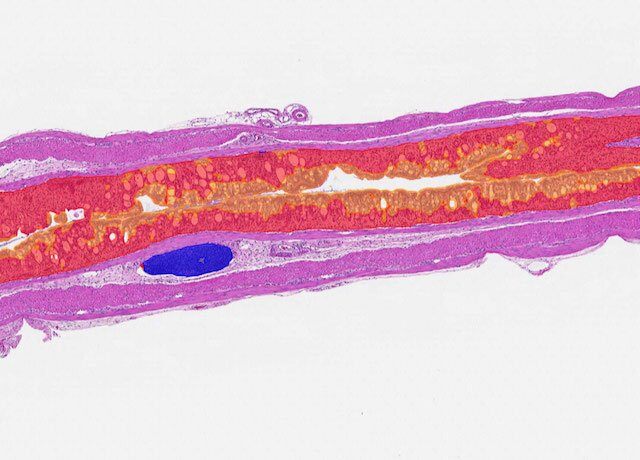 DSS_colitis_after