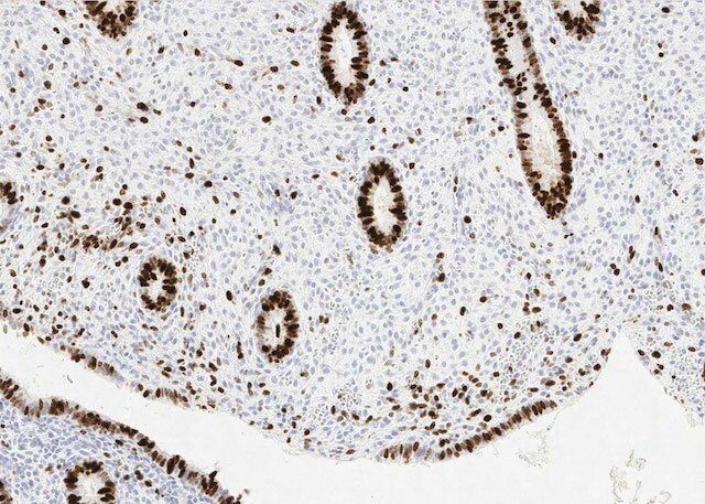 endometrium_epith+stroma_before