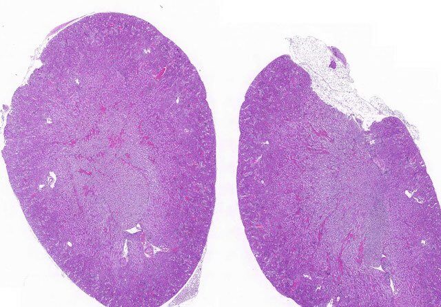 kidney_cortex_medulla_before