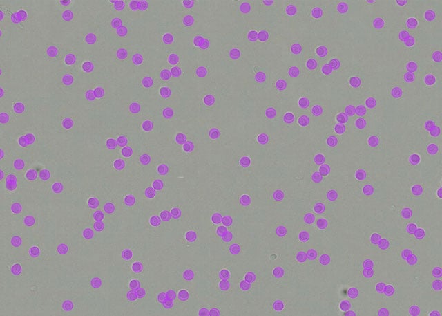 yeast_cells_after