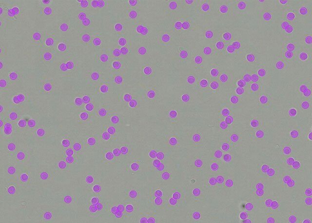 yeast_cells_after