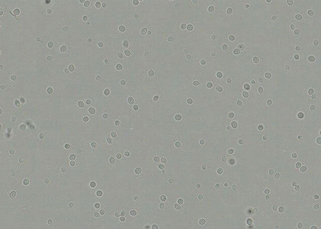 yeast_cells_before