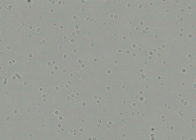 yeast_cells_before