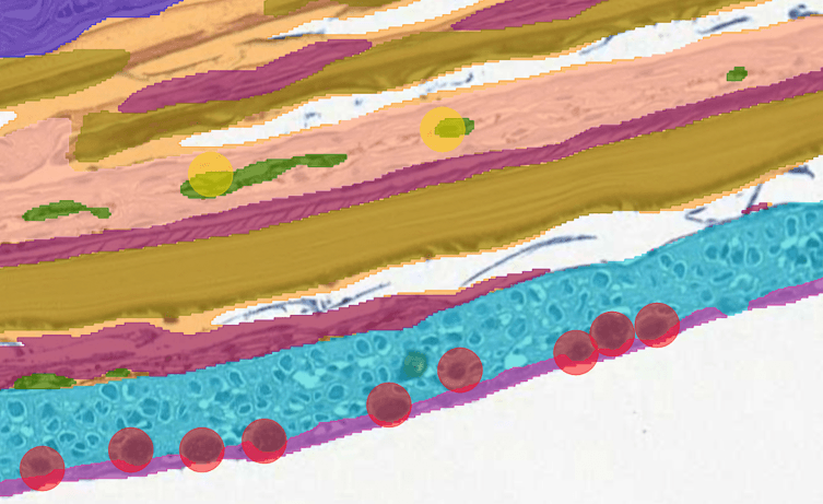 Food safety case study: salmon skin analysis by AI