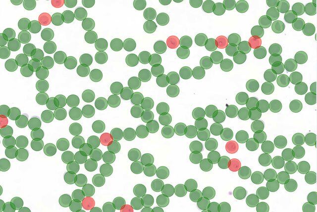 Case study: automating the detection of malaria parasites in blood smear