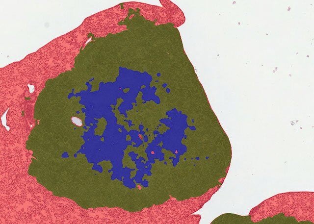 Tufts University case study: enhancing tuberculosis research with AI