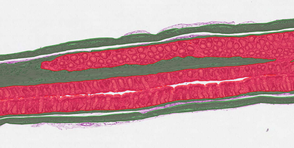 CRL case study: AI model for DSS-induced colitis