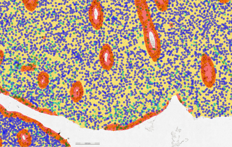 University of Oulu case study: AI in endometrial cell analysis
